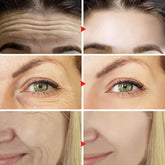 Home Wrinkle Removal Face Set with Firming Anti-Aging Serum and Eye Stick - Himpall